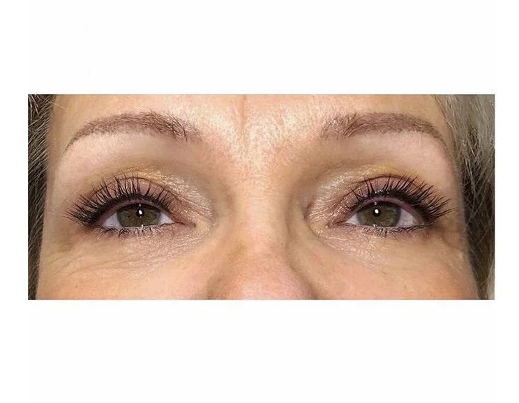 Ras de cil supérieur