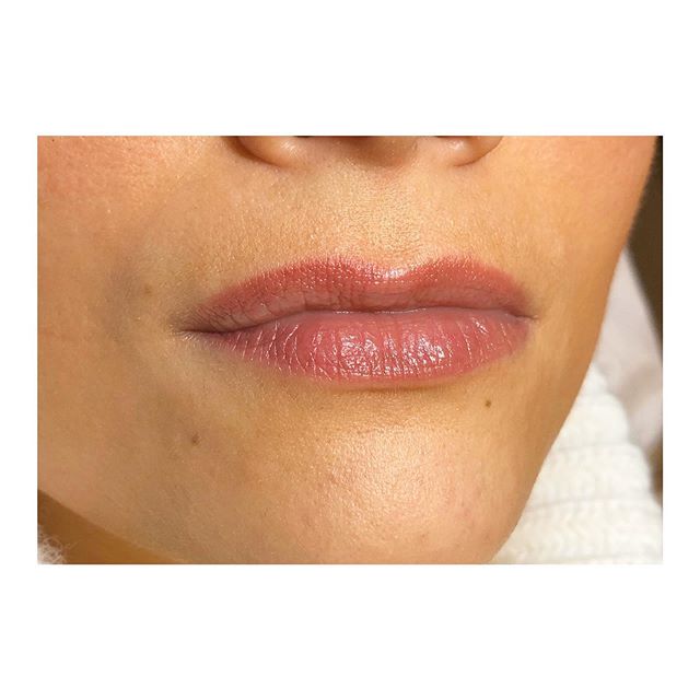😍 Maquillage Permanent des l&egrave;vres Candy Lips 🍭✨ (effectu&eacute; 1 an auparavant 😍)
R&eacute;sultat hyper naturel et garanti sans injection
.
.
.
#maquillagepermanent #maquillagepermanentlarochelle #larochelle #pmua #pmu #permanentmakeup #s