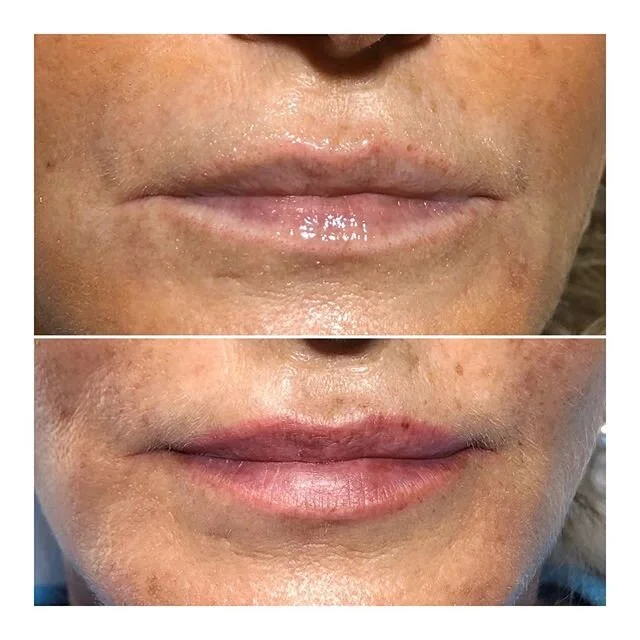 Tout en douceur, 
Le maquillage permanent des lèvres, idéal pour redessiner naturellement des lèvres trop fines, dépigmentées 
Tenue 3 ans .
.
.
.
.
#maquillagepermanent #maquillagepermanentlarochelle #larochelle #pmua #pmu #permanentmakeup #sou