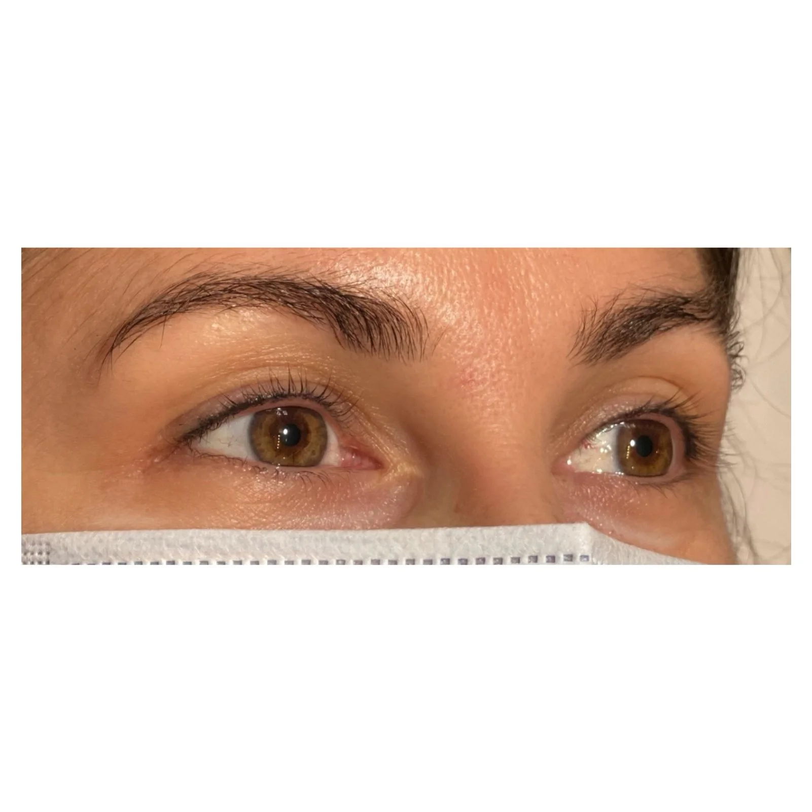 Ras de cil supérieur