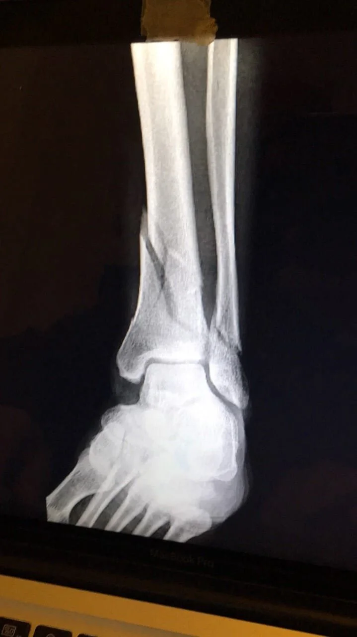 Život te uči najvećim lekcijama, što bolnija to jasnija...