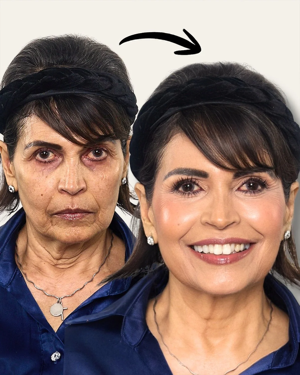 How To Cover DARK CIRCLES &amp; STOP Concealer From CREASING In Wrinkles