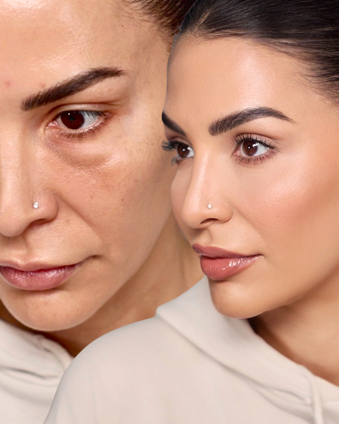 No More Under Eye Bags! How to Cover Them Up Instantly