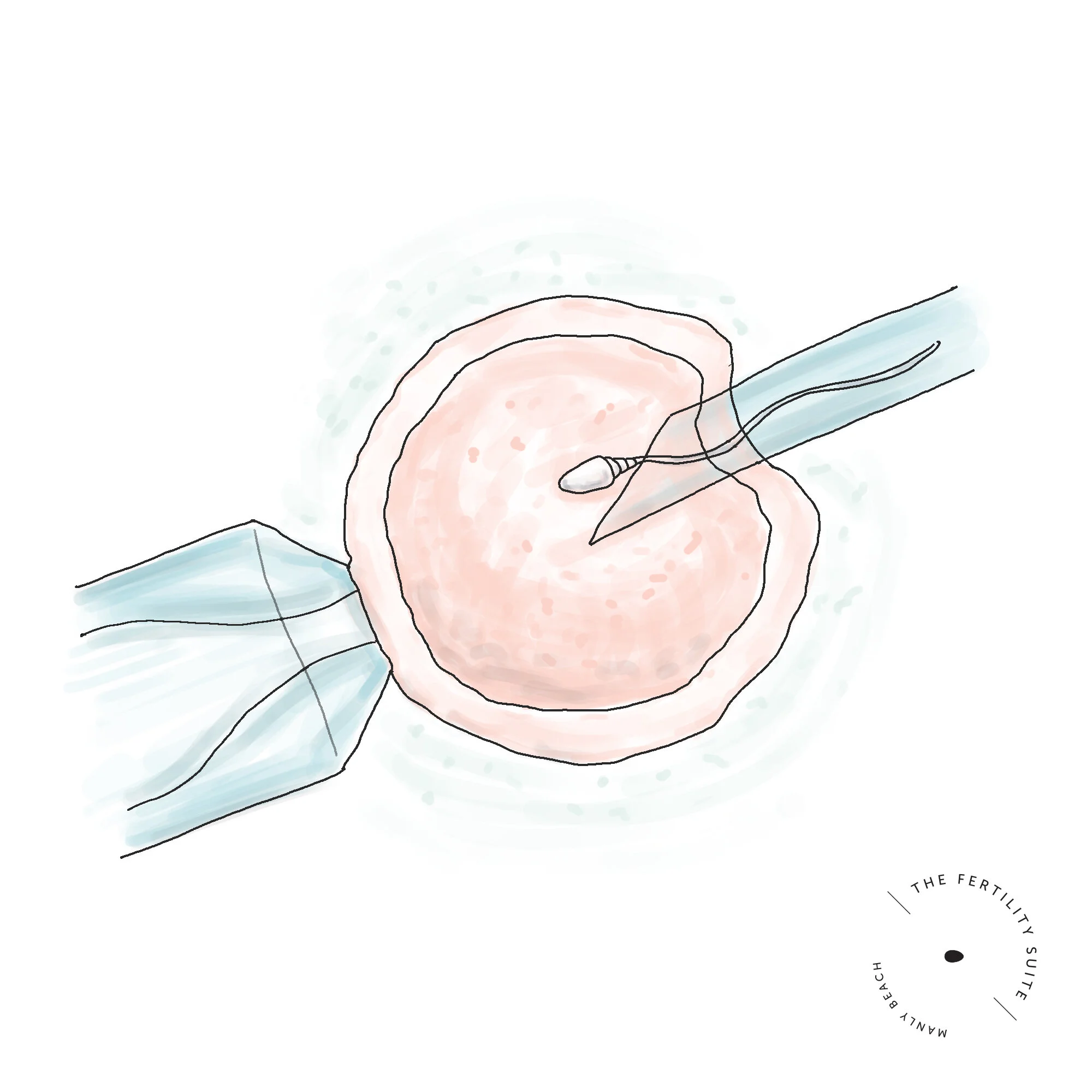Navigating the IVF bonus scheme.  7 questions to ask when choosing an IVF doctor.