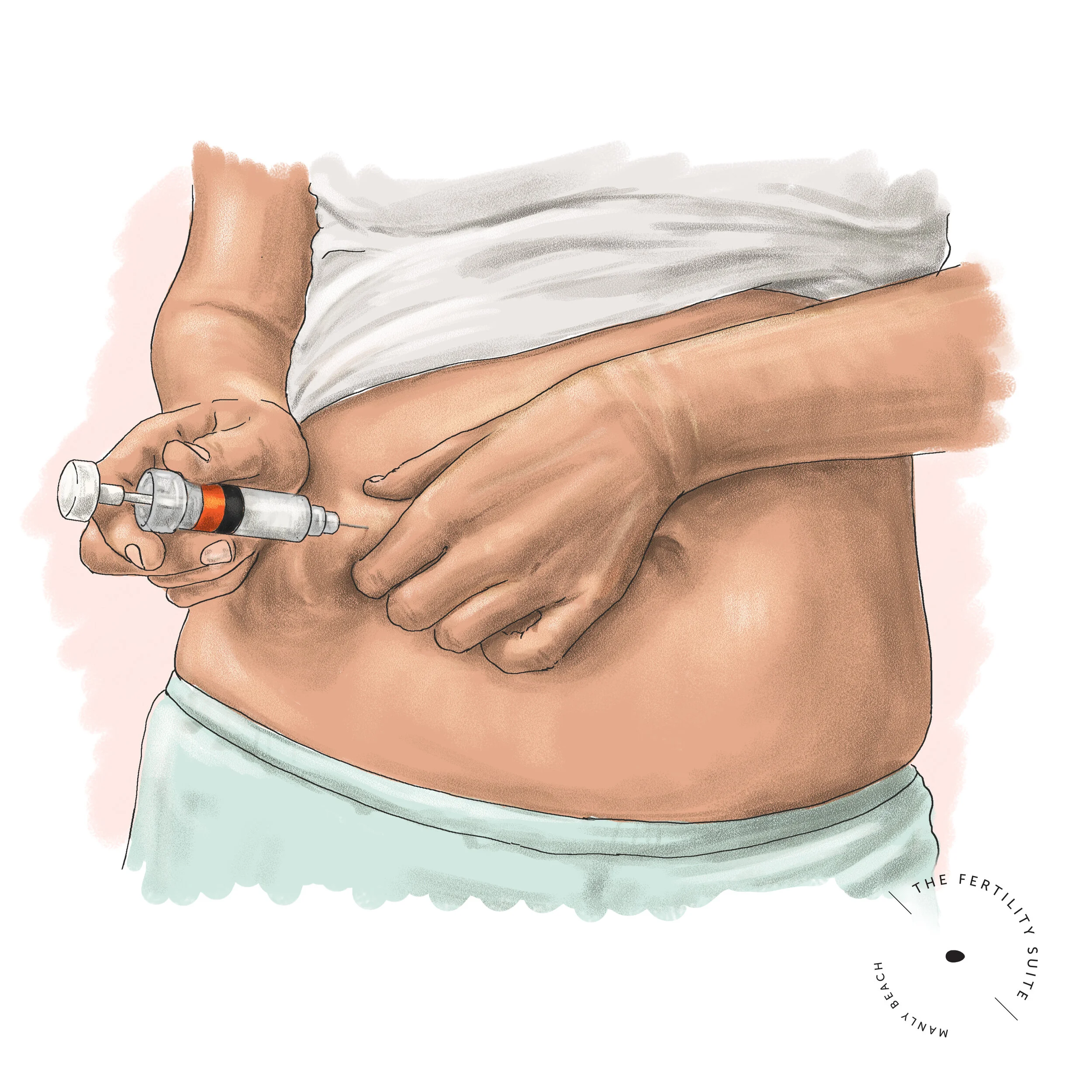 IVF:  Preparing to increase your chance of success