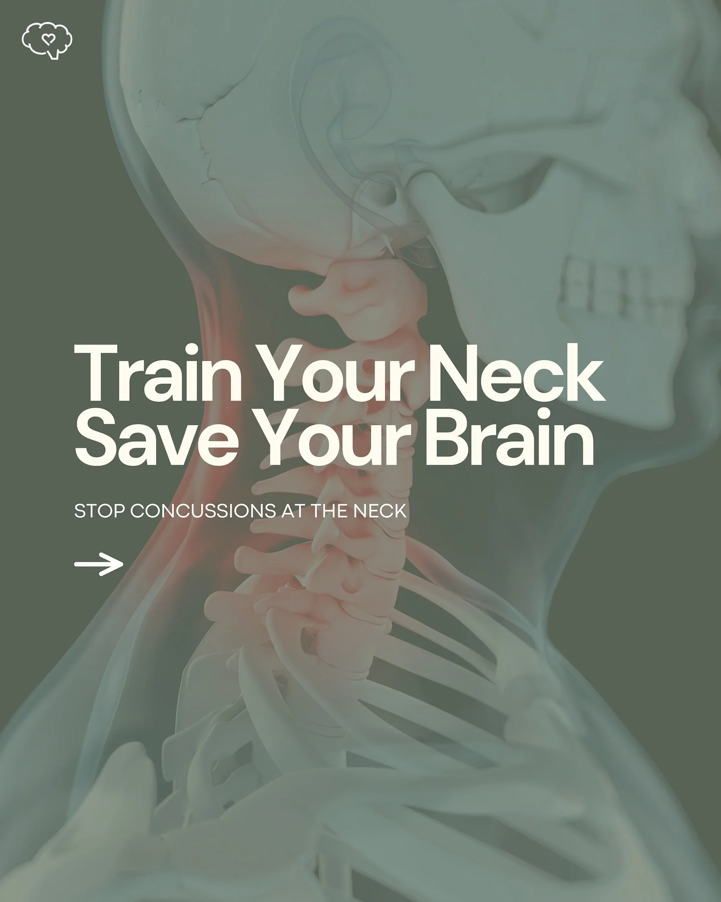 💪🧠 Did you know a strong neck can actually help protect your brain?

Neck strength improves head stability, reduces force during impacts, and lowers concussion risk.

✨ Quick tips: Simple moves like overhead press, rows, and chin tucks can make a b