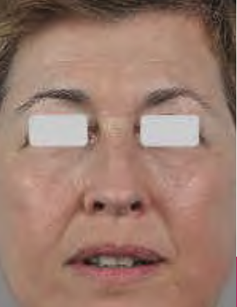SR1A.PNG
