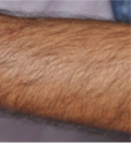 HR7B.PNG