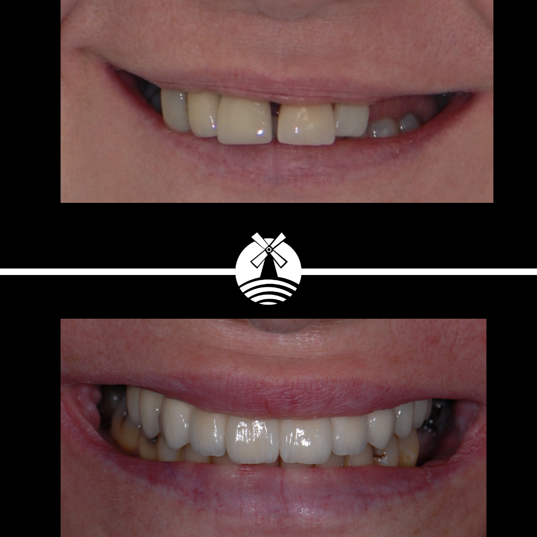 M J Kenyon Dental Surgeons Lytham — new patients! Family