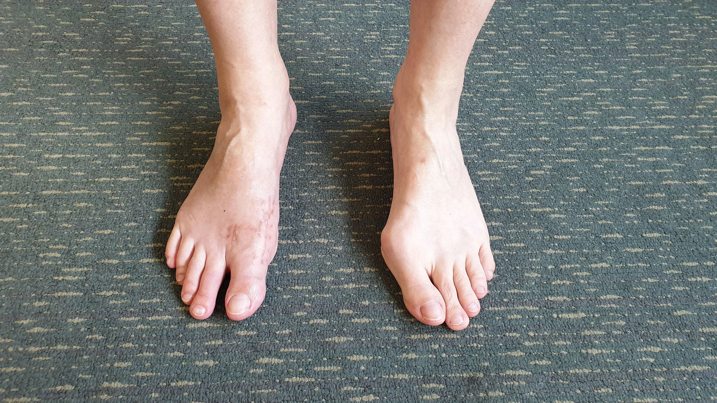 A/Prof Roderick Kuo Sydney Orthopaedic Foot and Ankle Surgeon