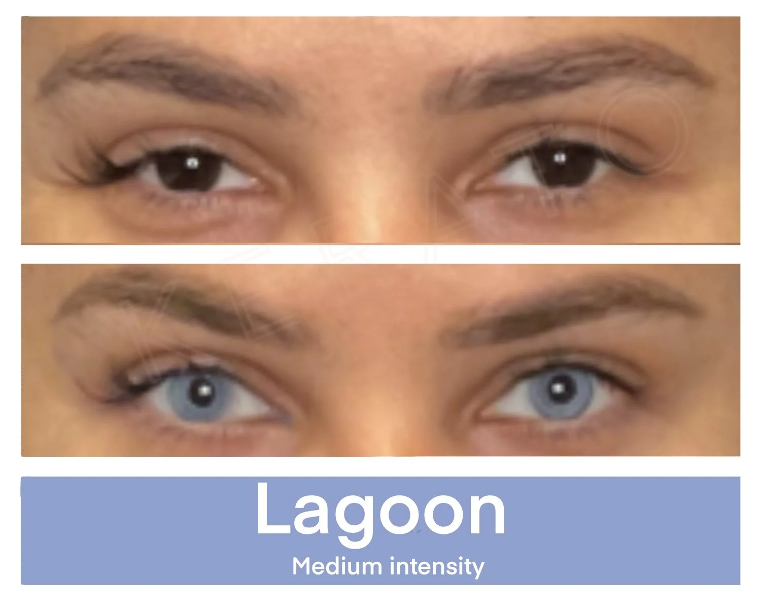 Results and Examples — Eye Color Change — KERATO