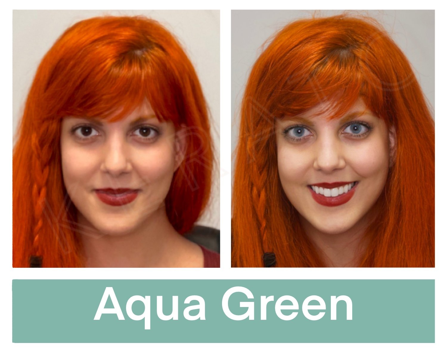 Kerato Procedure with Aqua Green Pigment