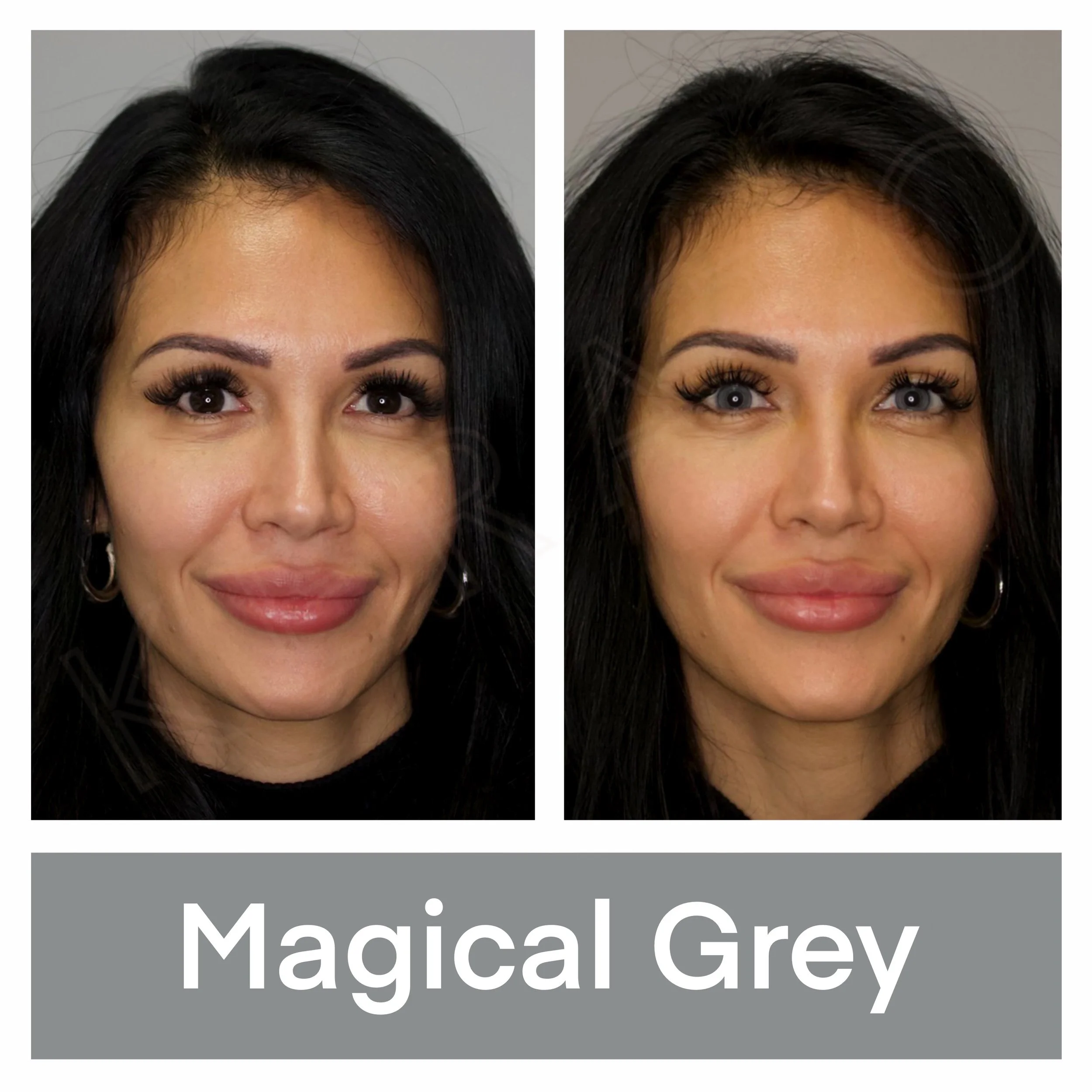 Results and Examples — Eye Color Change — KERATO