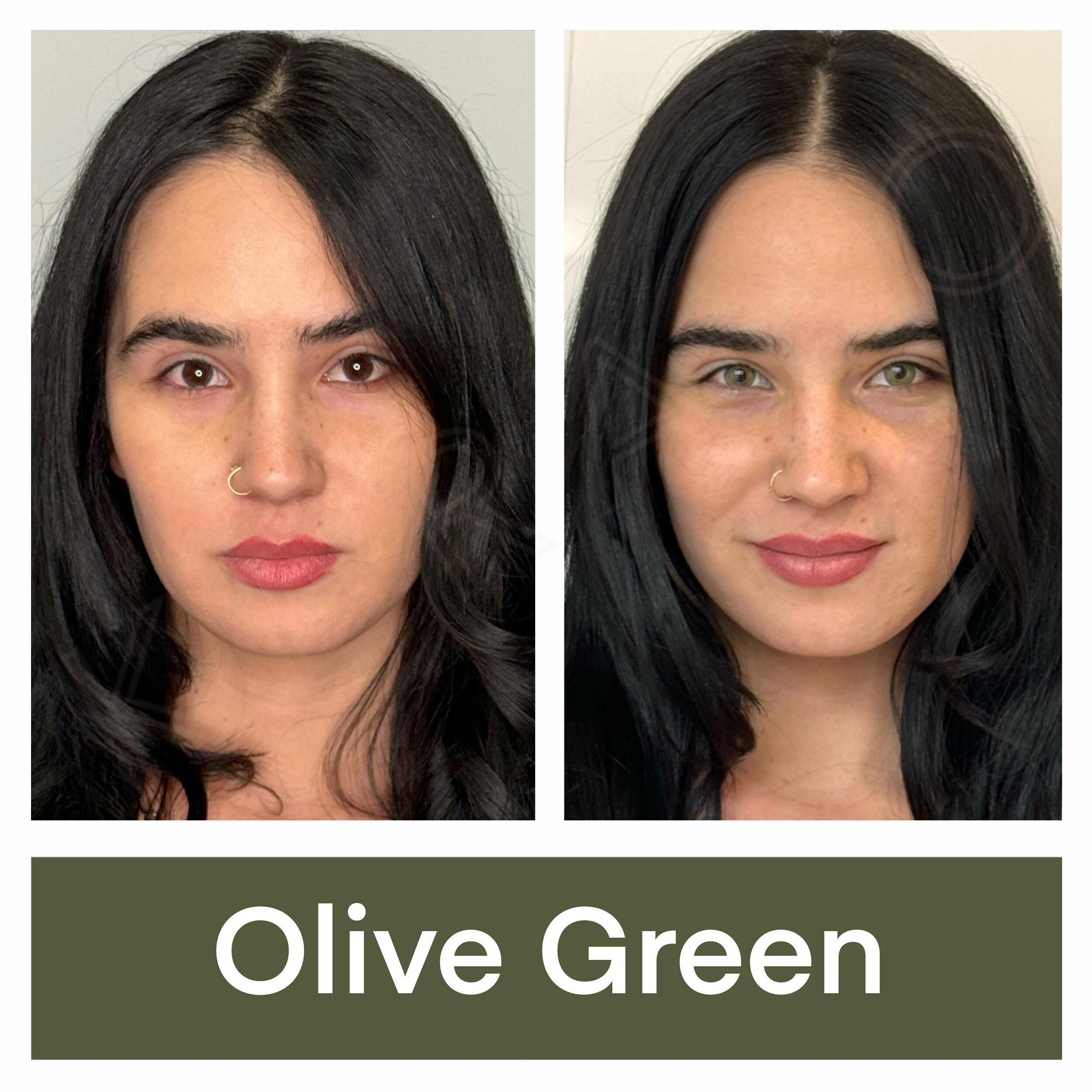 🫒OLIVE🫒 #olive #green #greeneyes #kerato_nyc_safe_eye_color_change  #doctormovshovich #kerato #ophthalmology #medicine  #eyedoctor #eye  #eyecolorchange  #keratopigmentation #safeeyecolorchange  #beauty #permanenteyecolorchange #cosmeticsurgery #pl