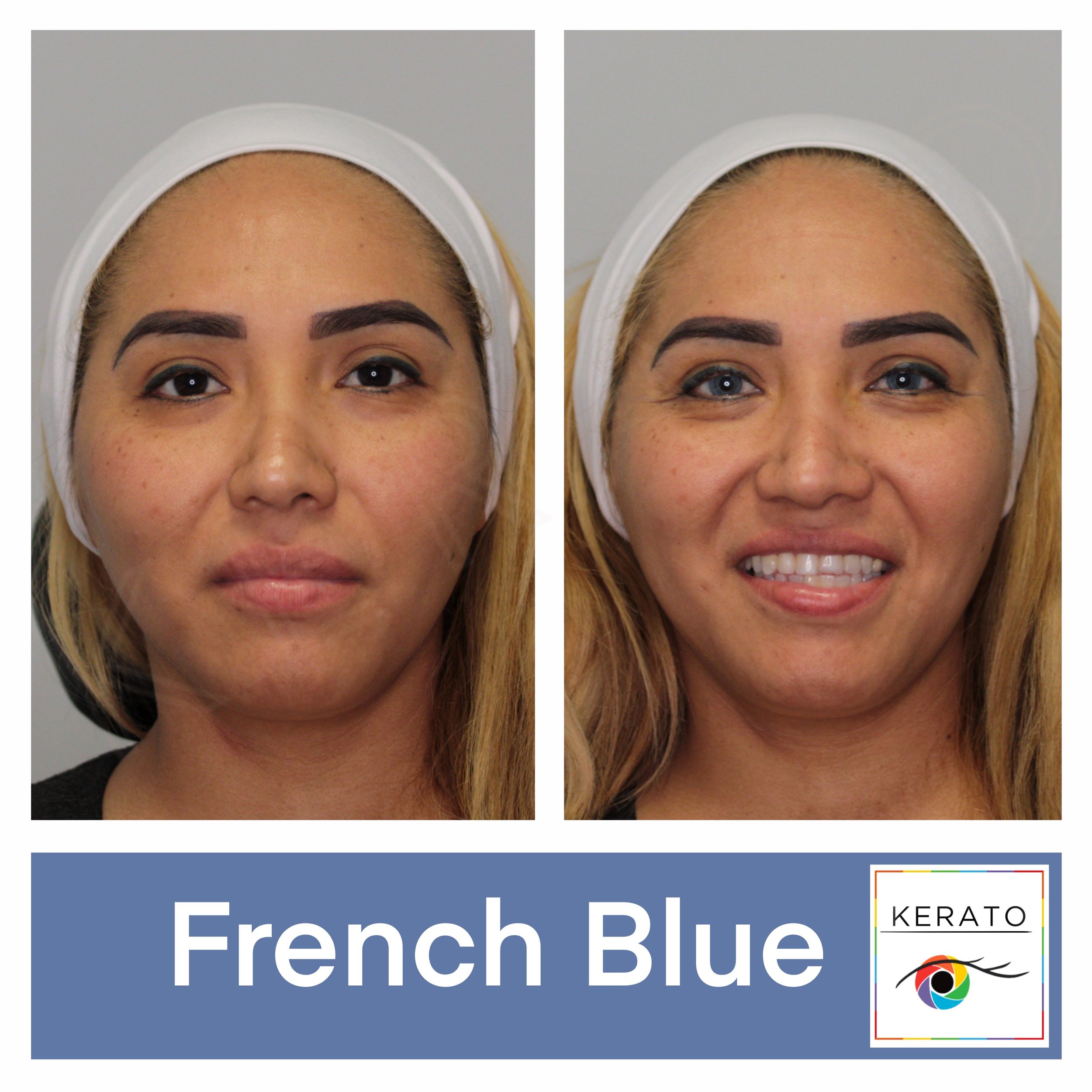 Eye Color Change with French Blue Pigment at KERATO