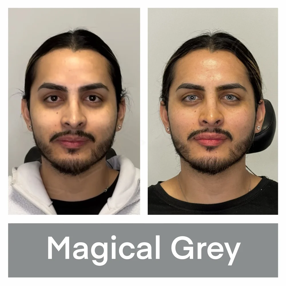 Results and Examples — Eye Color Change — KERATO