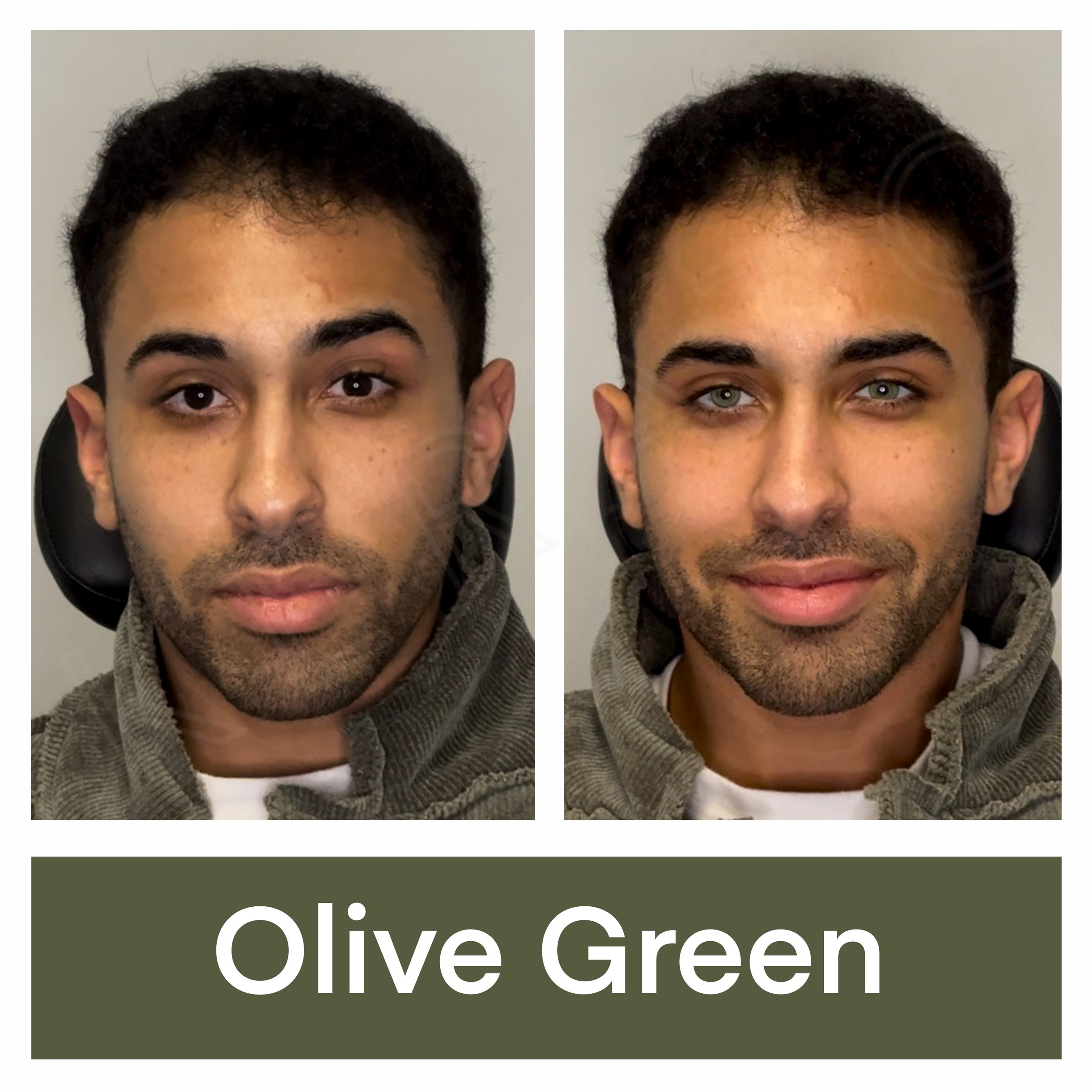 Eye Color Change with Olive Green Pigment at KERATO