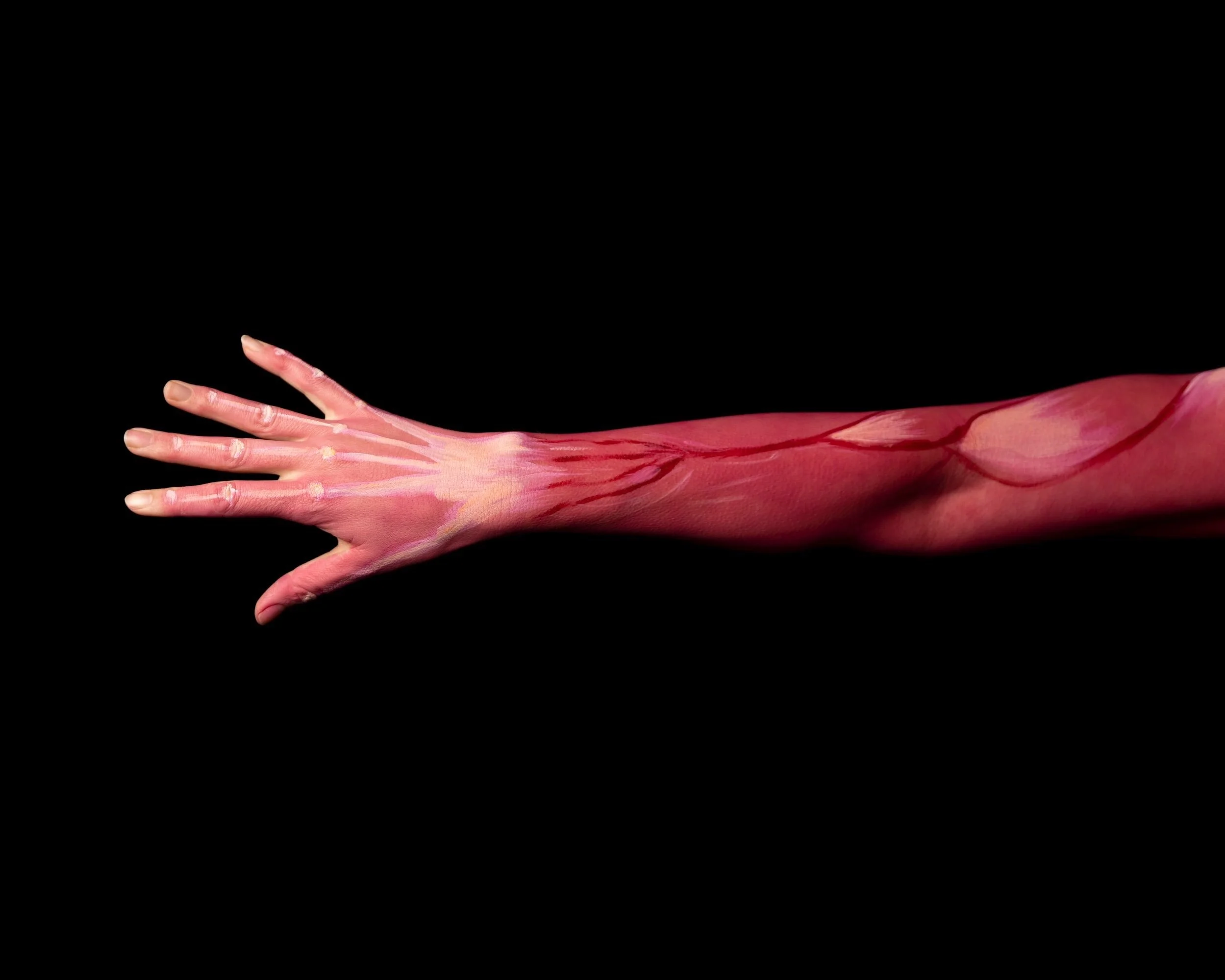 Brachioradialis and Injuries