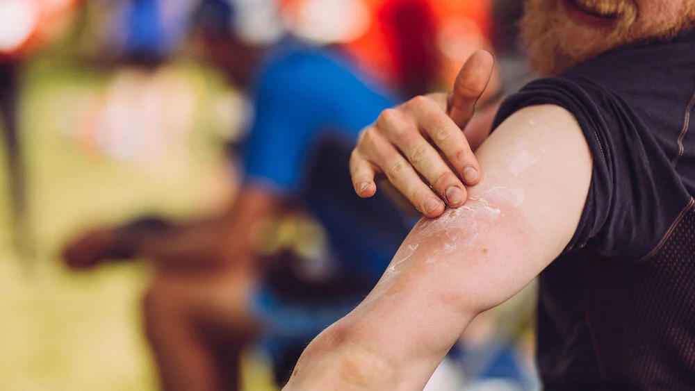 Sun Cream is mandatory kit - Don’t forget to apply it before it is too late! ©Guillem Casanova​