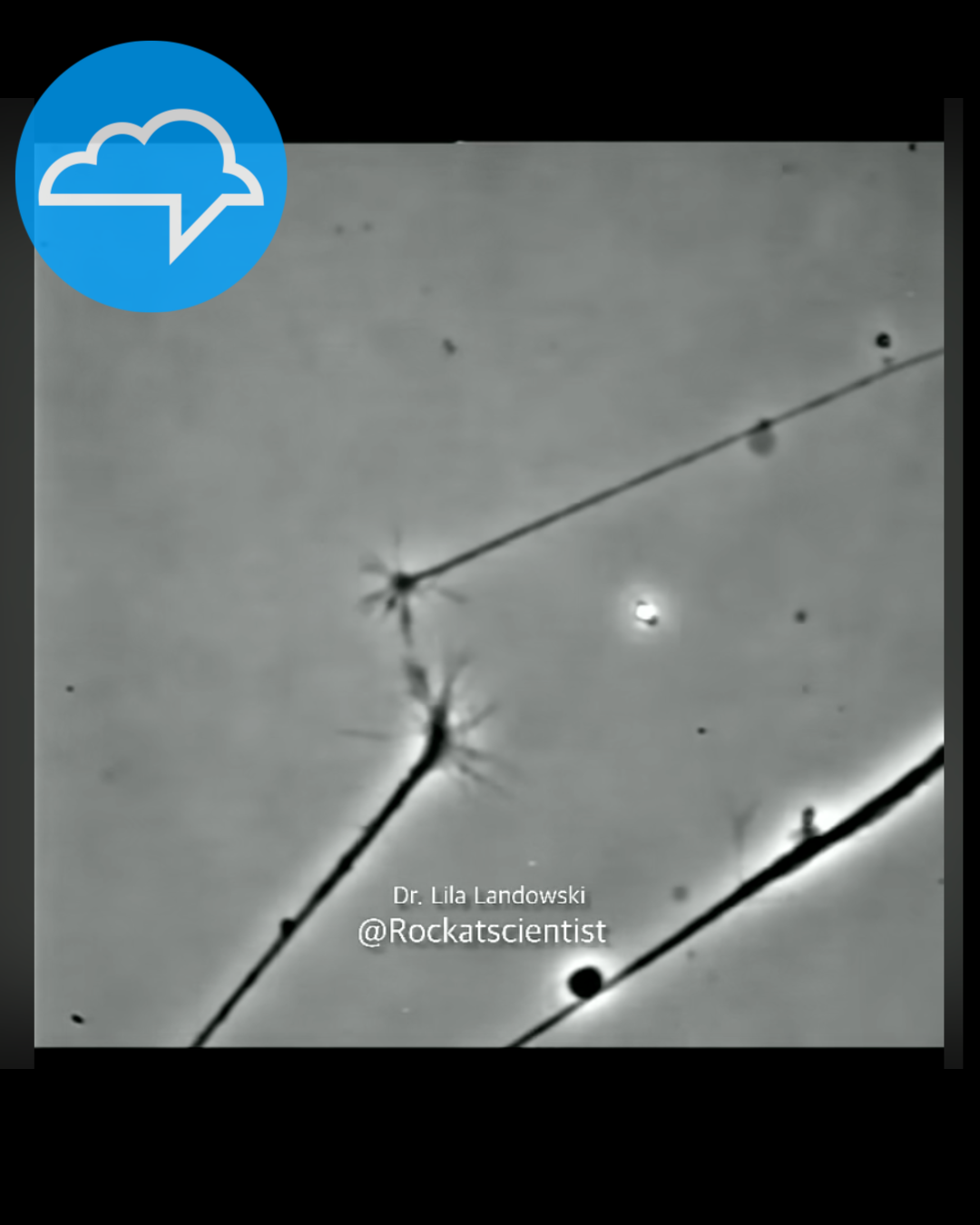 How Does Speech Therapy Work, Anyway? SLPs as Neurological Engineers