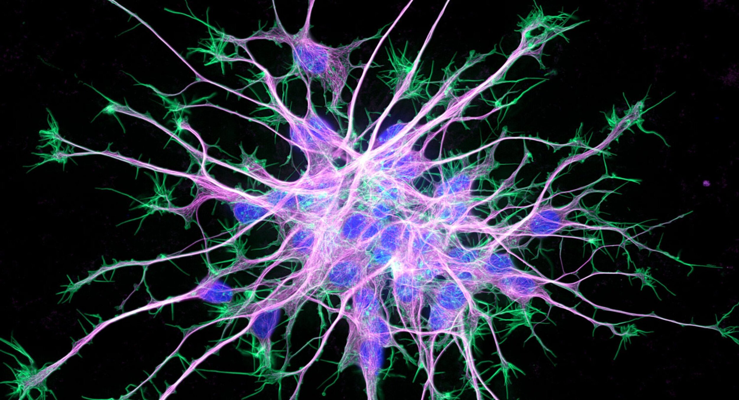 Как называются клетки головного мозга. Нейрональные стволовые клетки. Нейрон Мартинотти. Гиппокамп Нейроны. Нейроны микроскопия.