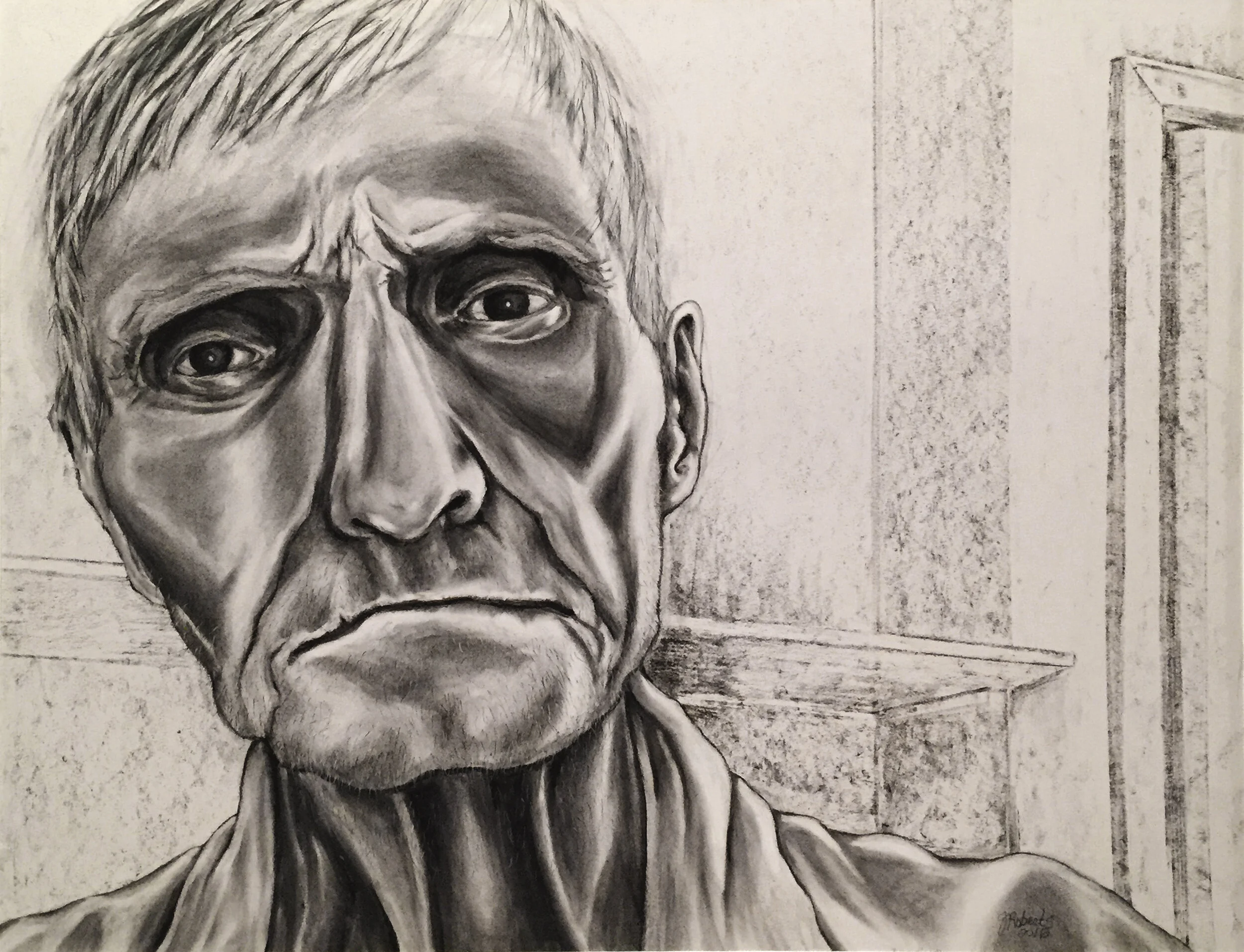 Plummeting into the Abyss - The Ravages of Alzheimer's