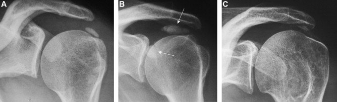 calcific9.jpg