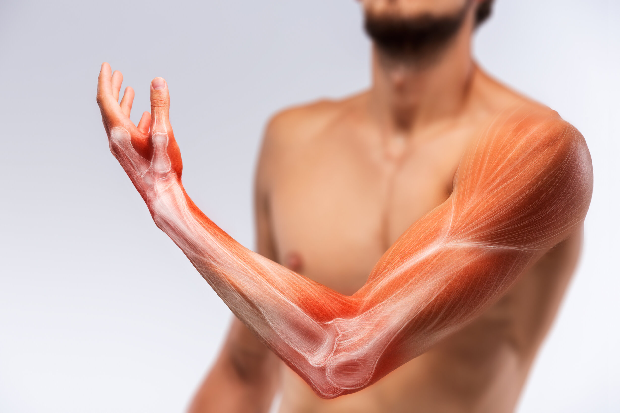 Заболевание мышц рук. Заболевания плечевой мышцы. Мышечные расстройства.
