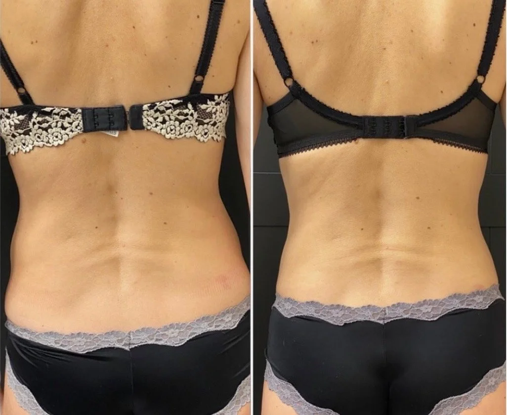 Morpheus Love Handles