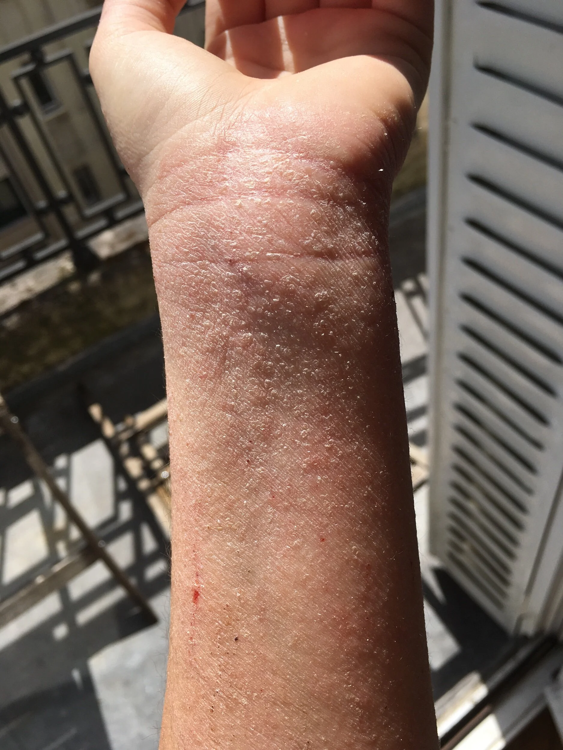 Jus de céleri & Eczéma avis après test — Sask and the Cities