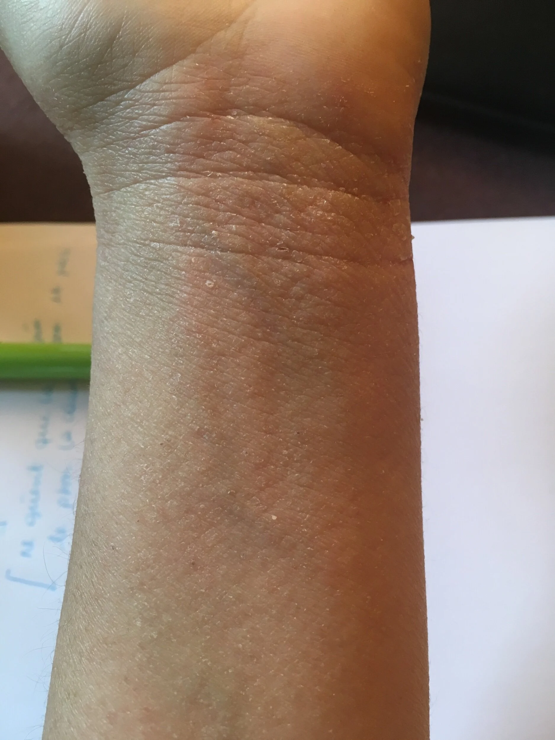 Jus de céleri & Eczéma avis après test — Sask and the Cities