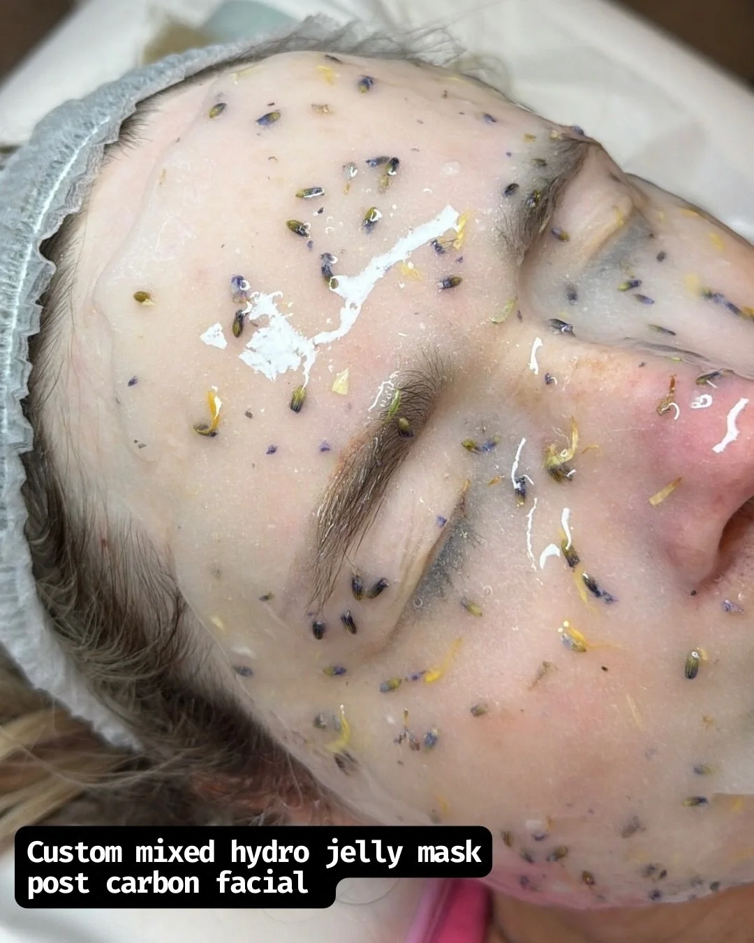 The glow doesn&rsquo;t stop at your carbon facial&hellip; 👀✨

Finishing your treatment with a custom-mixed Hydro Jelly Mask takes your results to the next level 💧

After a carbon facial, your skin is deeply cleansed and more receptive&mdash;making 