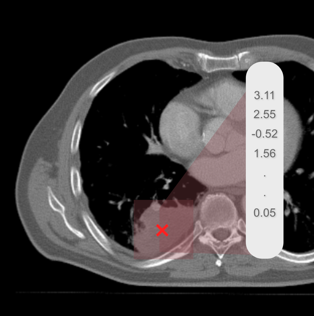AIM study in the news!