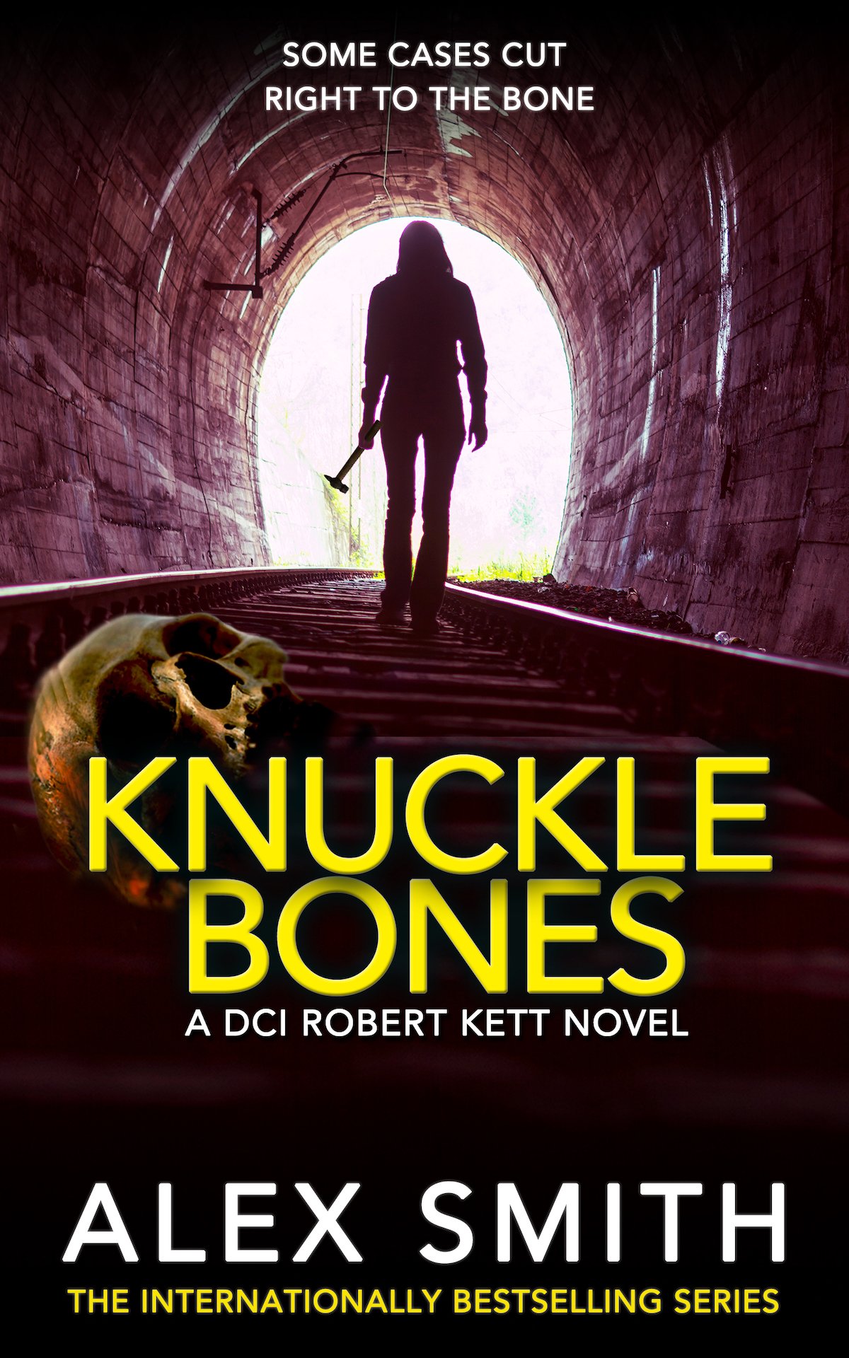 knuckle bones2 copy.jpg