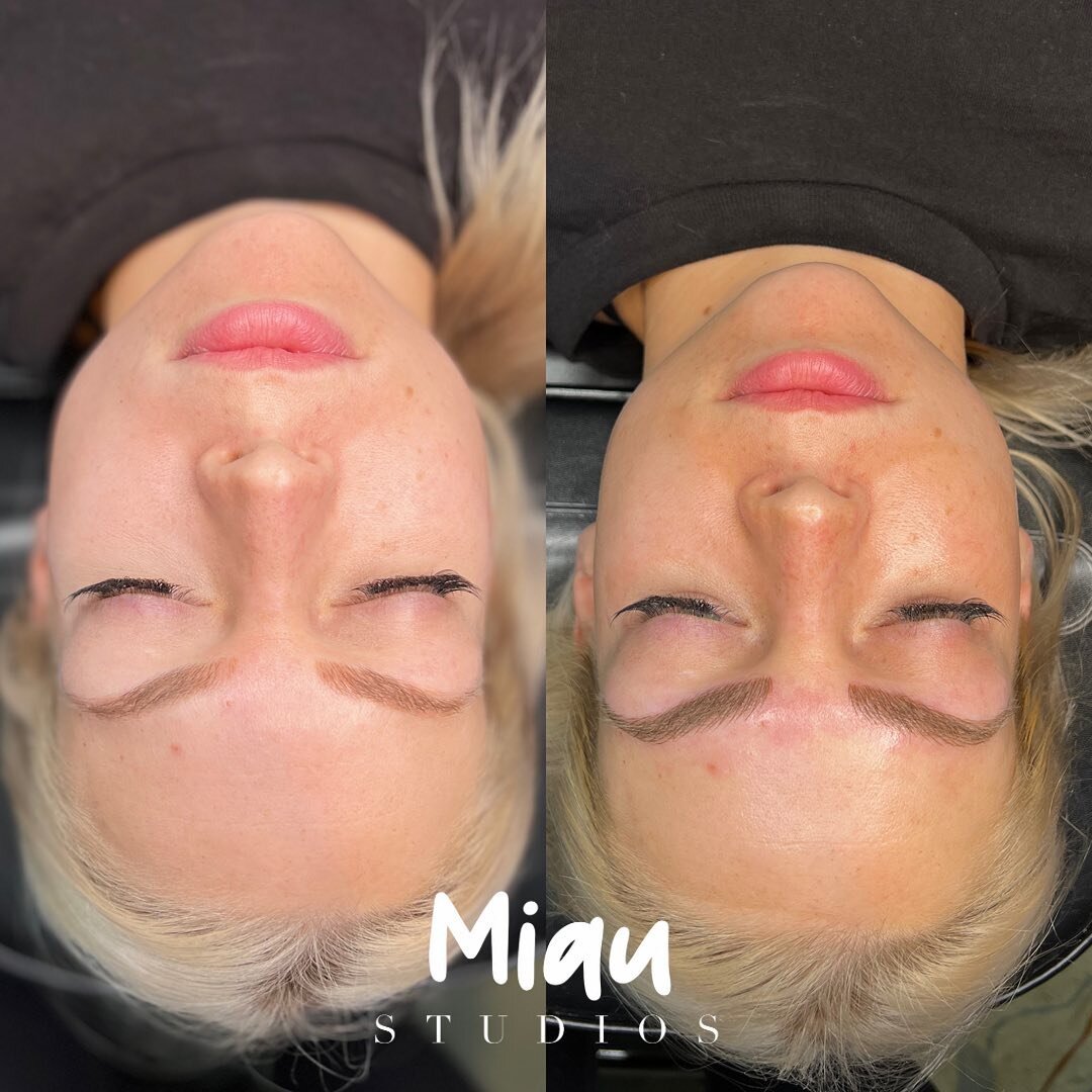 Combo Brow Colour Correction &amp; Brow Touch Up ! Loving the shape took to the Blonde a little pink added a colour corrector to bring the life back into the Beautiful Brows ! 

BOOK TODAY | LINK IN BIO

#combobrows #brows #browgame #yxe #sk #skbrows