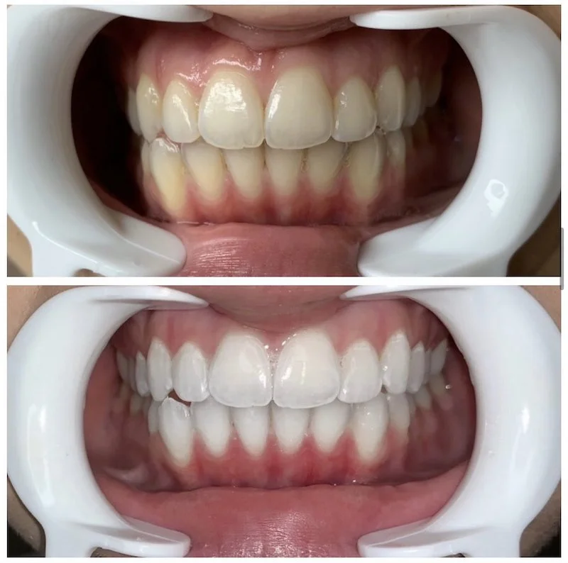 Teeth.jpeg