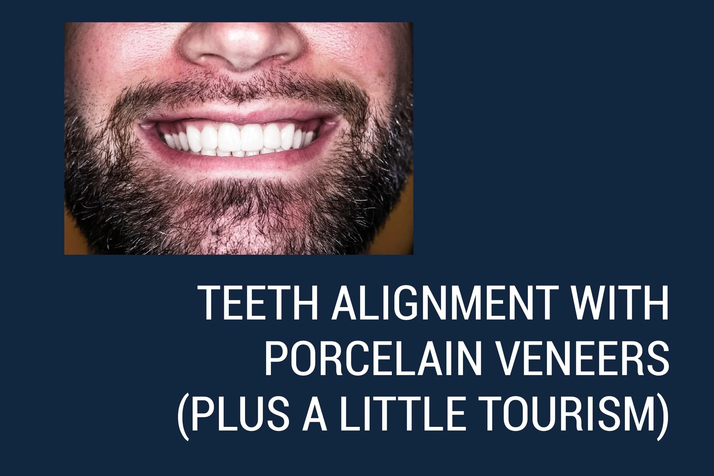 TEETH ALIGNMENT WITH PORCELAIN VENEERS (plus a little tourism)