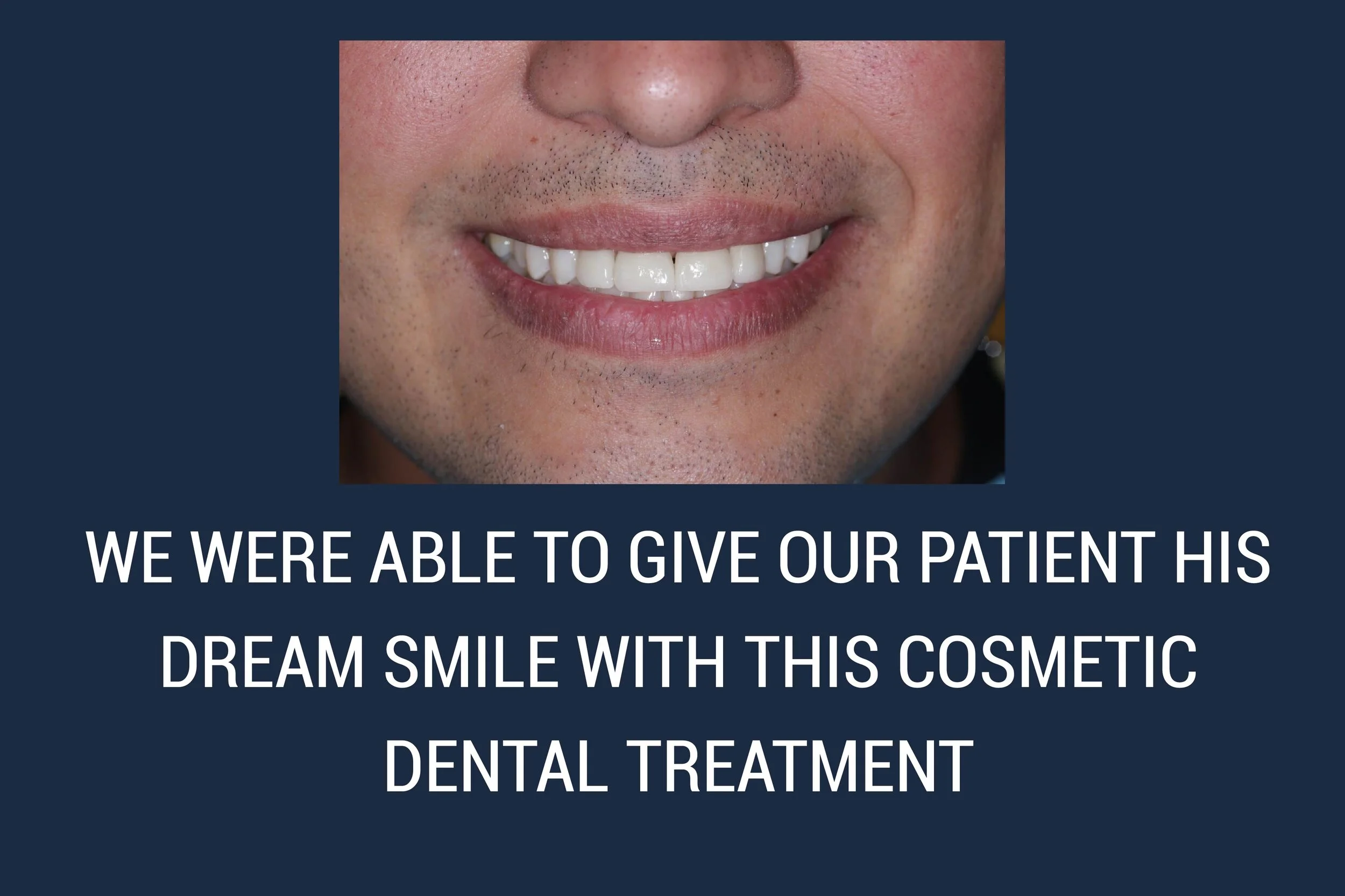 WE WERE ABLE TO GIVE OUR PATIENT HIS DREAM SMILE WITH THIS COSMETIC DENTAL TREATMENT