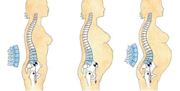 pregnancy posture.jpg