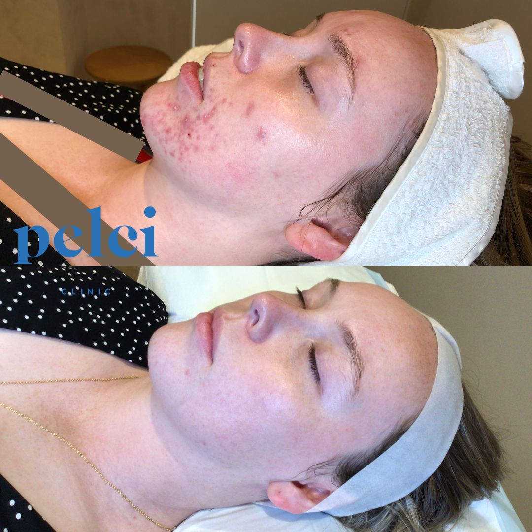 BEFORE & AFTERS-10.png
