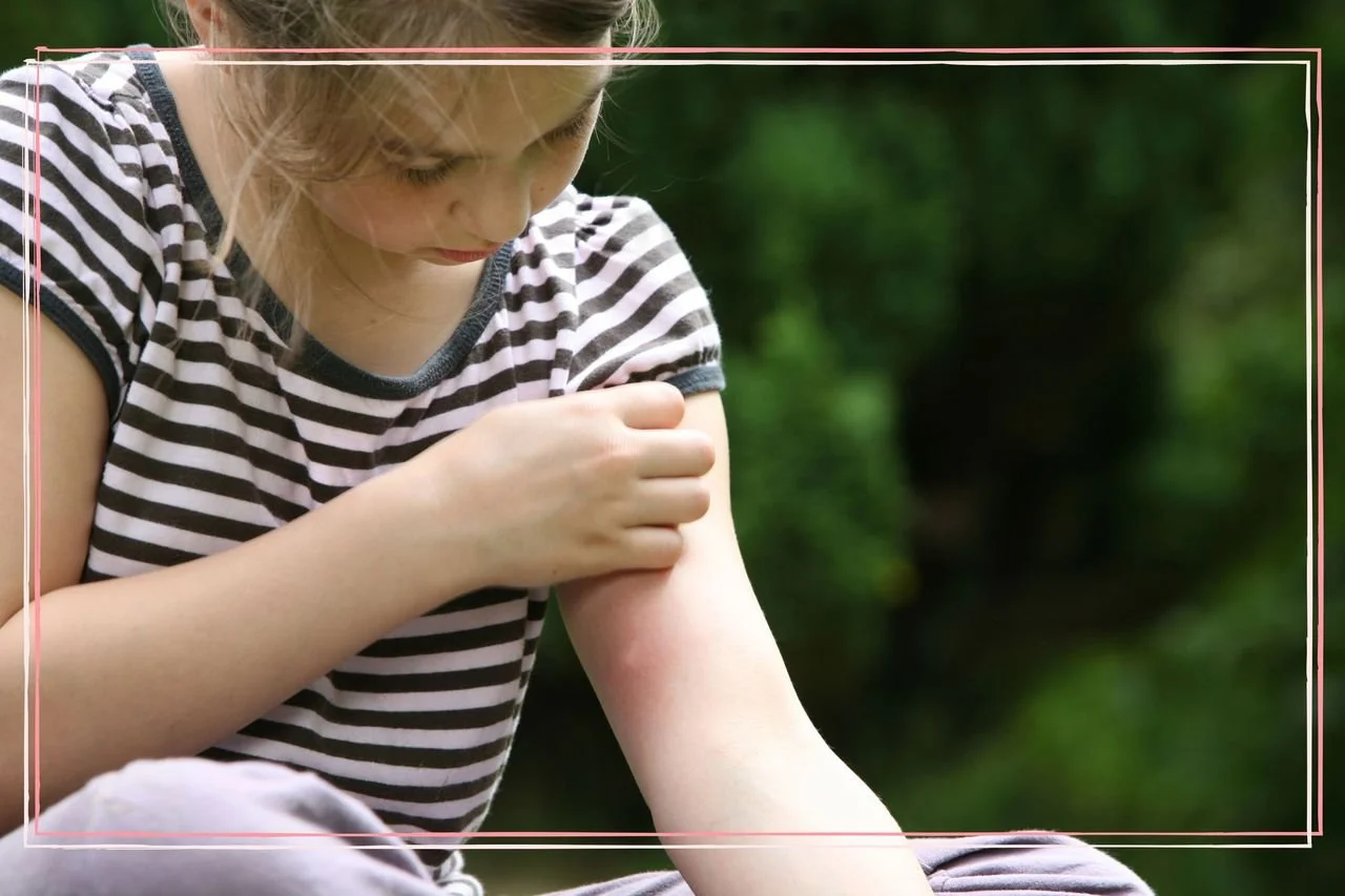 Natural Relief: Top Homeopathic Remedies for Bites and Stings