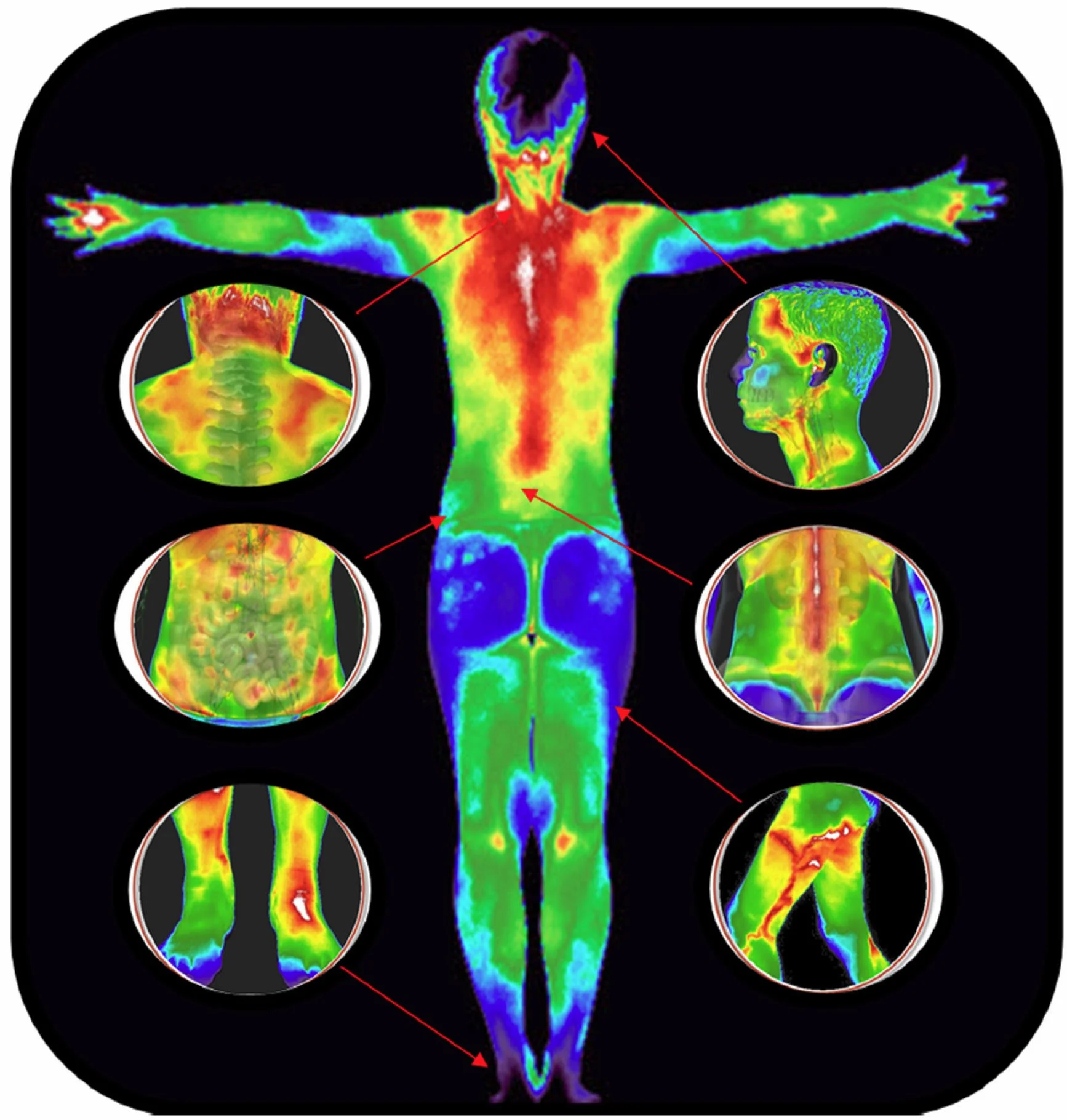 What Can Thermography Really Tell Us About Our Health?