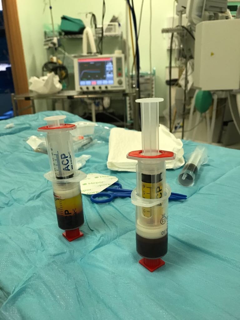 4. Separated Plasma and Red Cells