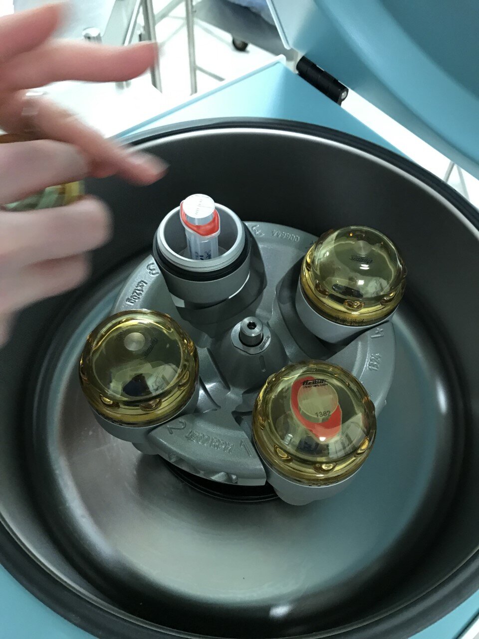 2. Centrifuge System