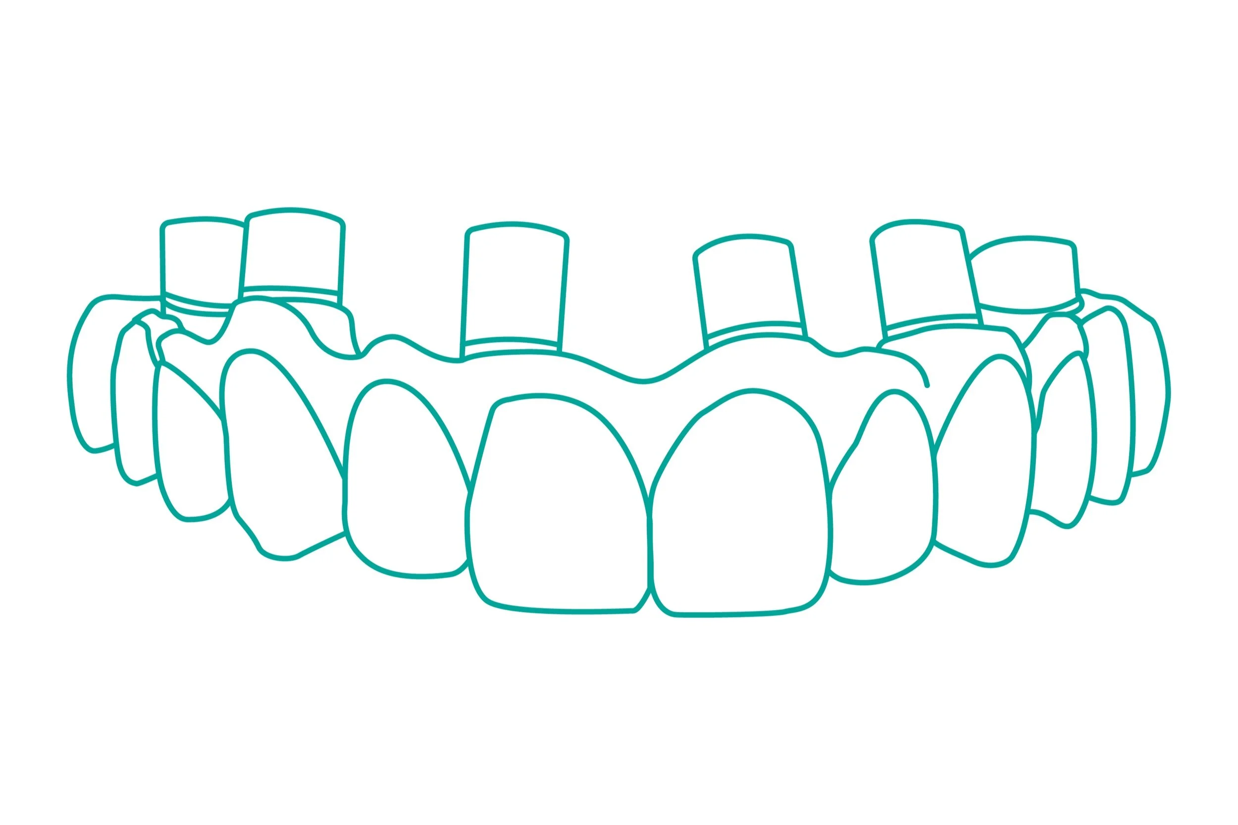 4 Points Dental Designs