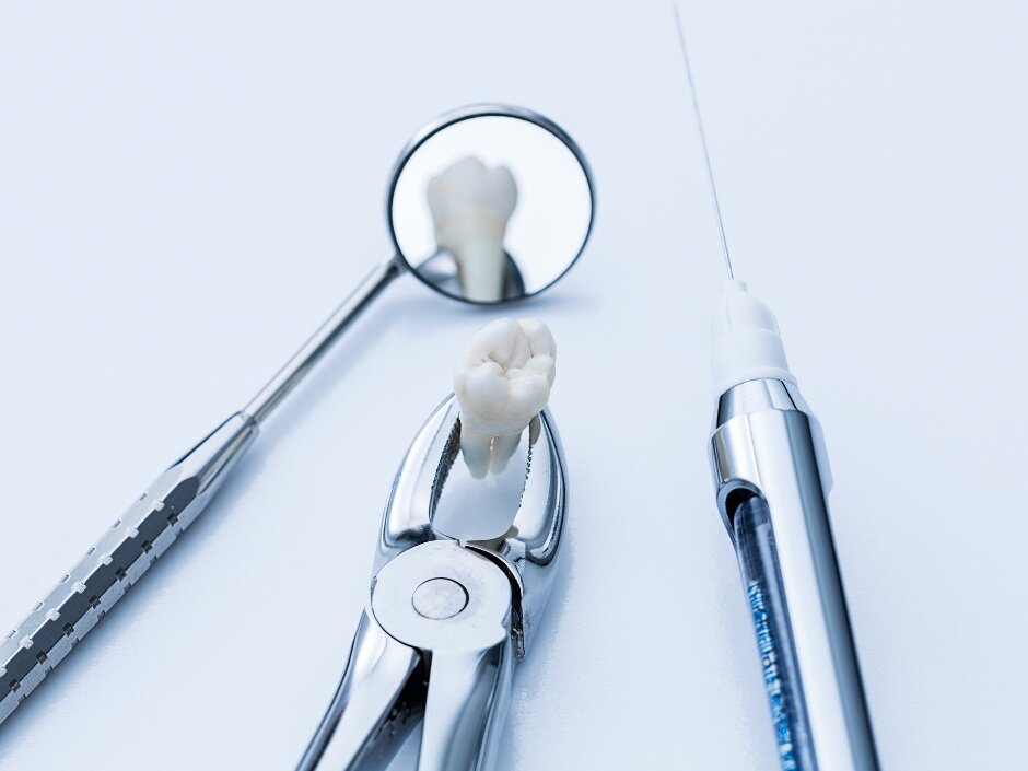 Tooth Removal / Extraction — New Sudbury Dental