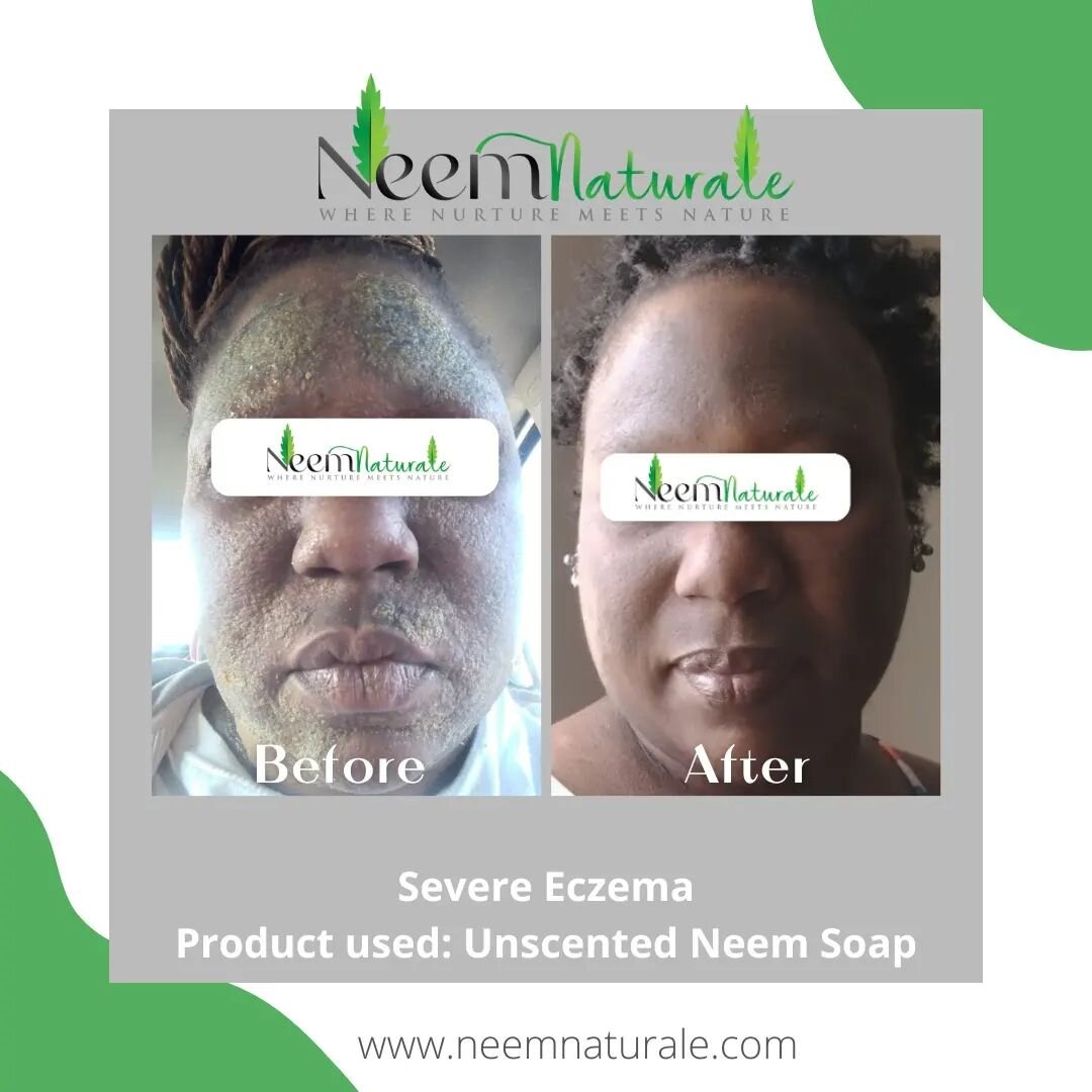 Neem Naturale