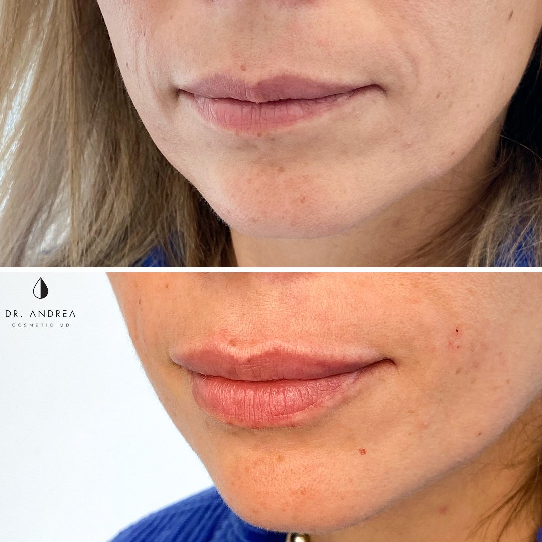 B&A 69 - LIPS.jpg