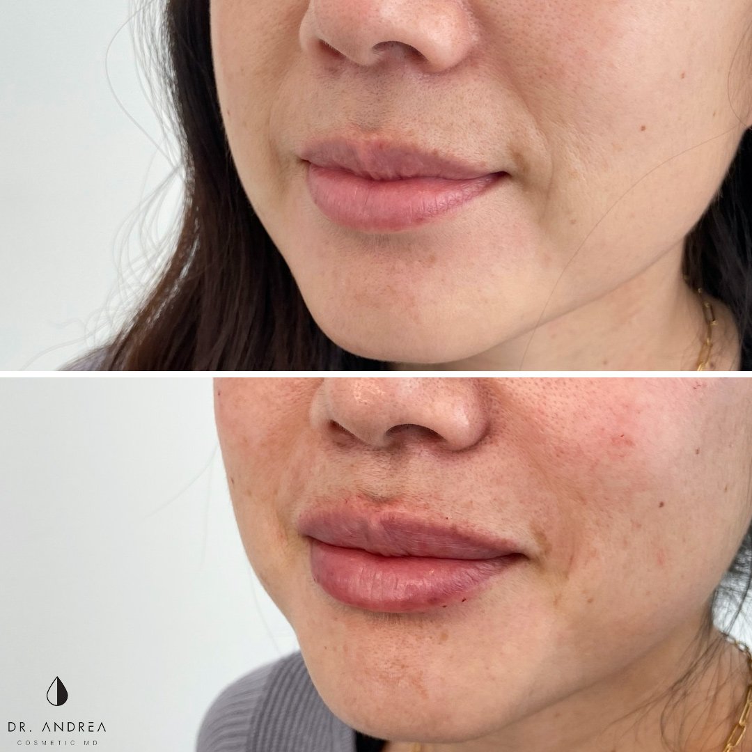 B&A 107.2 - NFL & LIPS.jpg