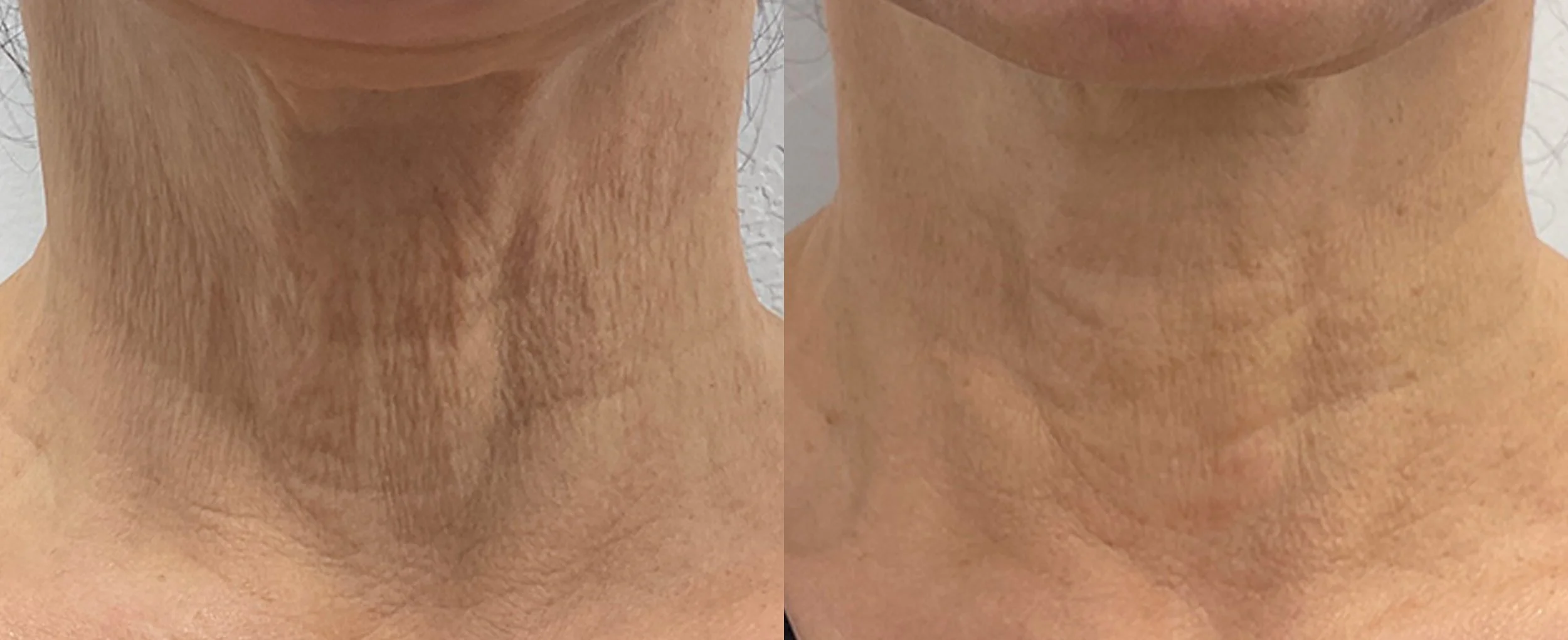 P4_SF_M8_Female_Neck_Crop-TM.jpg